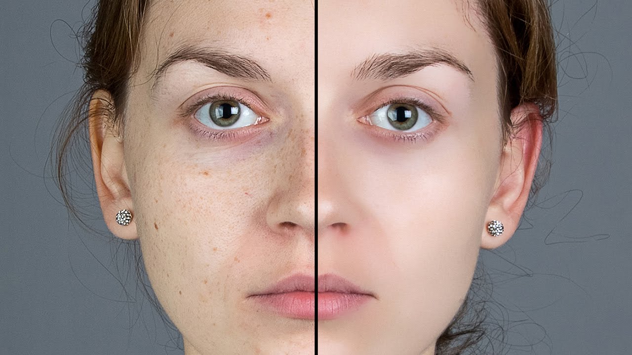 How To Remove Facial Blemishes 28